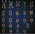 180px-Chromosom kariotyp.gif